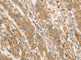 CPB1 Polyclonal Antibody Store at -20°C