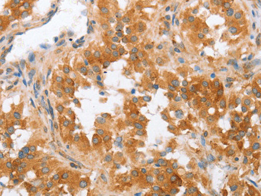 CRELD2 Polyclonal Antibody Store at -20°C
