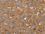 CD59 Polyclonal Antibody Store at -20°C