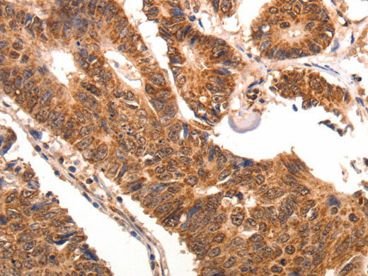 CCL17 Polyclonal Antibody