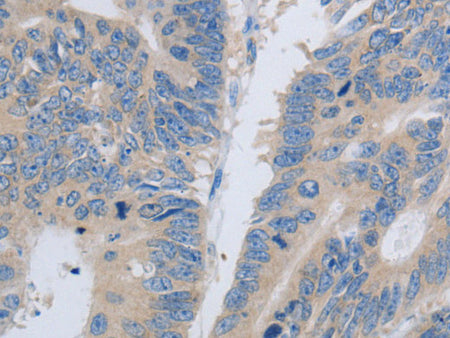 PAWR Polyclonal Antibody Store at -20°C