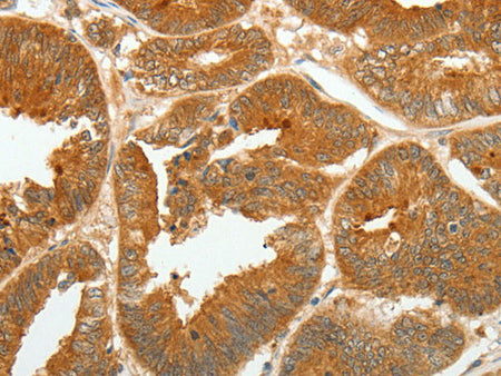 ASCL1 Polyclonal Antibody Store at -20°C