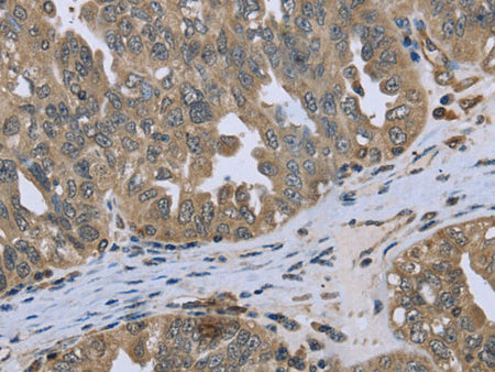 DCTN4 Polyclonal Antibody Store at -20°C