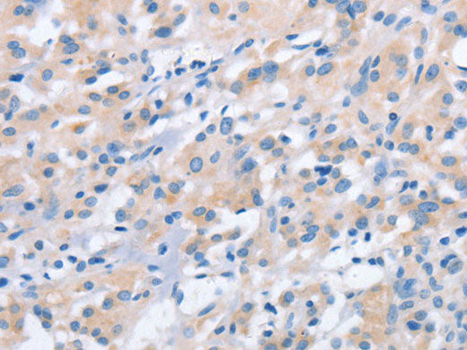 NCAPD2 Polyclonal Antibody Store at -20°C