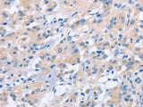 NCAPD2 Polyclonal Antibody Store at -20°C