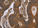 FGFRL1 Polyclonal Antibody