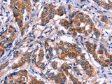 EIF2AK4 Polyclonal Antibody Store at -20°C