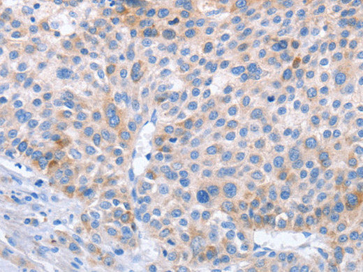 STK4 Polyclonal Antibody Store at -20°C