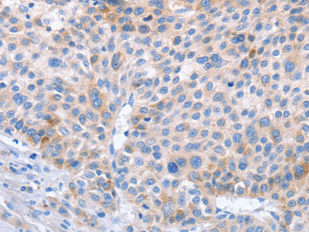 STK4 Polyclonal Antibody Store at -20°C
