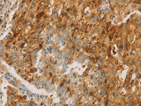 CEACAM8 Polyclonal Antibody Store at -20°C