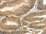 S100A4 Polyclonal Antibody Host Rabbit
