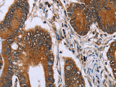IHH Polyclonal Antibody Store at -20°C