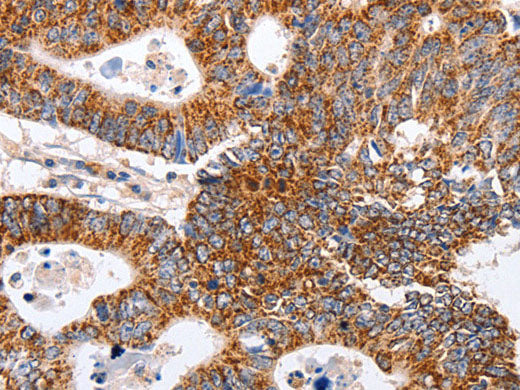 MAP2K5 Polyclonal Antibody Store at -20°C