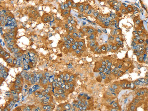 PYGL Polyclonal Antibody Store at -20°C