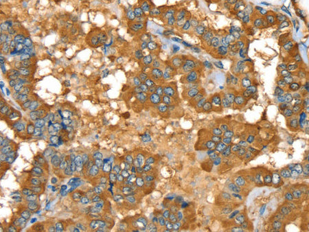 PYGL Polyclonal Antibody Store at -20°C