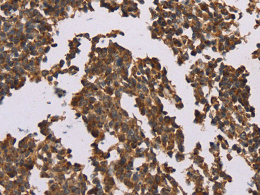 OTC Polyclonal Antibody Store at -20°C