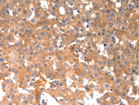 BGLAP Polyclonal Antibody Store at -20°C