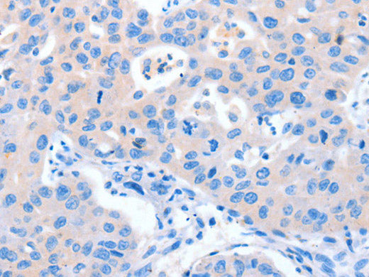 NUAK1 Polyclonal Antibody Store at -20°C