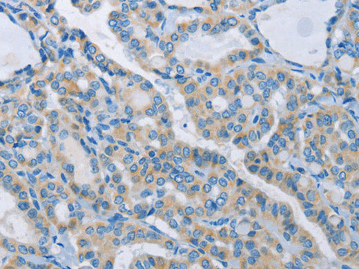 NEK5 Polyclonal Antibody