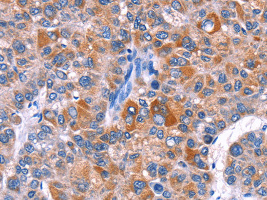 ELP2 Polyclonal Antibody Store at -20°C