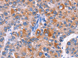 ELP2 Polyclonal Antibody Store at -20°C