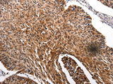 RAB41 Polyclonal Antibody Store at -20°C