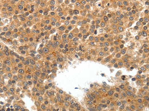 TEK Polyclonal Antibody Store at -20°C