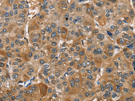 TRIP4 Polyclonal Antibody Store at -20°C