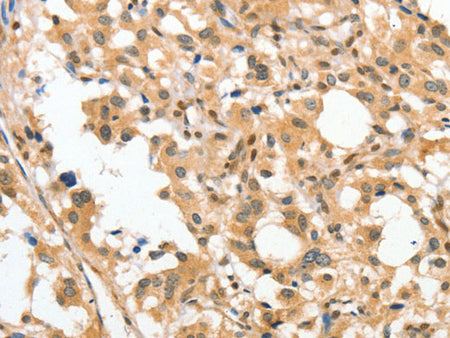 APTX Polyclonal Antibody 	Store at -20°C