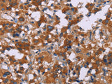 ERK1/2 Polyclonal Antibody