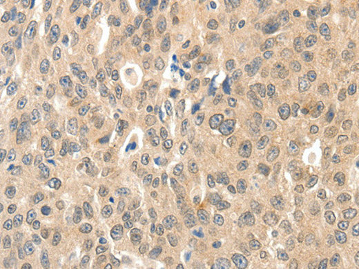 ROS1 Polyclonal Antibody Store at -20°C
