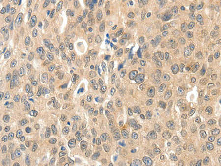ROS1 Polyclonal Antibody Store at -20°C