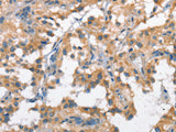 SCARB1 Polyclonal Antibody Store at -20°C