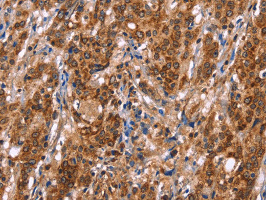 TDP2 Polyclonal Antibody Store at -20°C