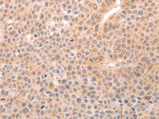 TRPC3 Polyclonal Antibody Store at -20°C