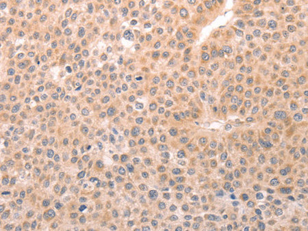 TRPC3 Polyclonal Antibody Store at -20°C