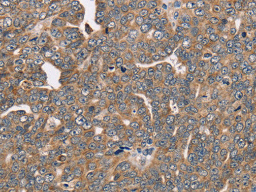 FAIM2 Polyclonal Antibody Store at -20°C
