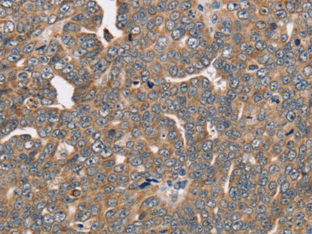 FAIM2 Polyclonal Antibody Store at -20°C