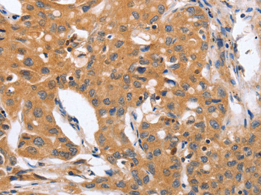 BLNK Polyclonal Antibody Store at -20°C