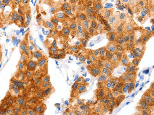 GLUT-4 Polyclonal Antibody Store at -20°C