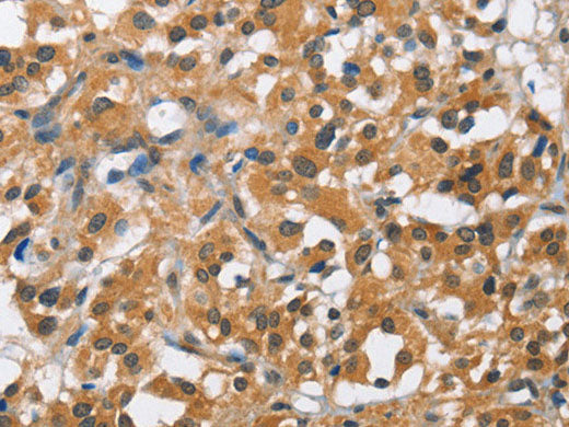 BCL10 Polyclonal Antibody Store at -20°C