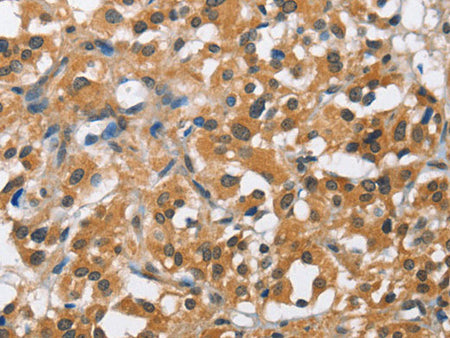 BCL10 Polyclonal Antibody Store at -20°C