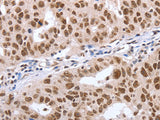 Oct-6 Polyclonal Antibody