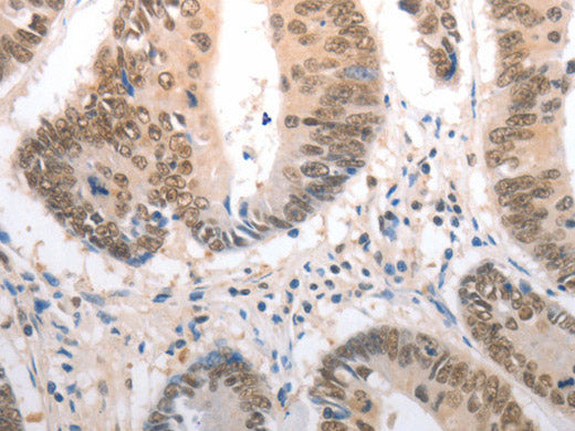 RAD50 Polyclonal Antibody Store at -20°C