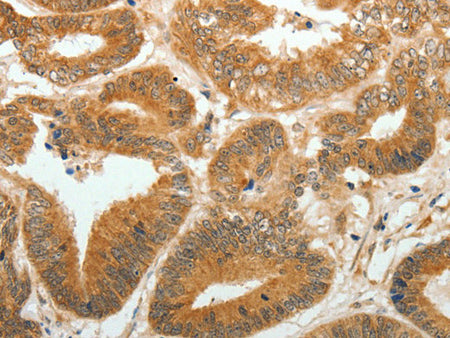 AKR1C1 Polyclonal Antibody Store at -20°C