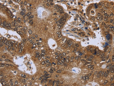 FHIT Polyclonal Antibody Store at -20°C