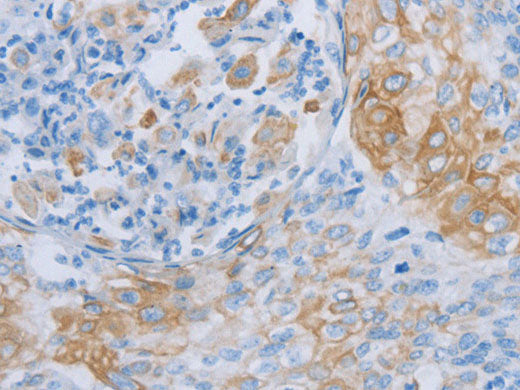ADRB3 Polyclonal Antibody Store at -20°C