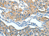 SERPINA3 Polyclonal Antibody Store at -20°C