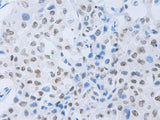 c-Fms Polyclonal Antibody Store at -20°C