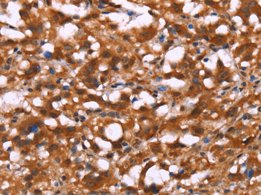 BRK1 Polyclonal Antibody Store at -20°C